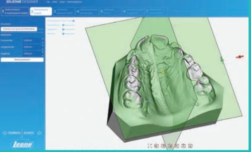 cad-دندانپزشکی